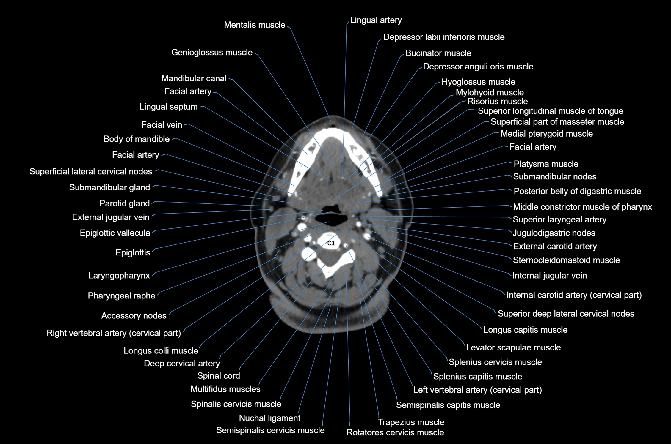 CT Neck axial cross sectional anatomy radiology image-img-00001-00034.webp